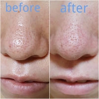 Dot Washy Bye Bye សាប៊ូលាងមុខ