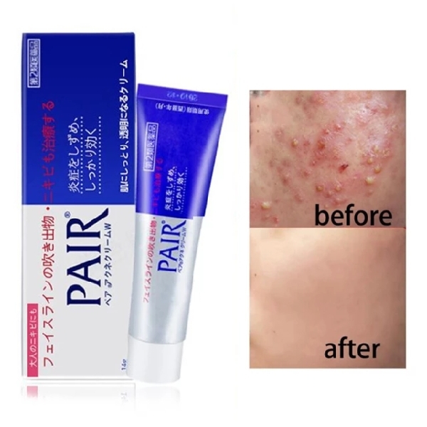 LION Pair Acne Care Cream