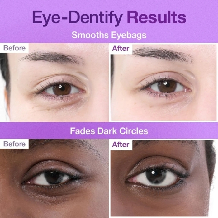 Numbuzin No.9 NAD Under Eye Patches/ម៉ាសភ្នែក