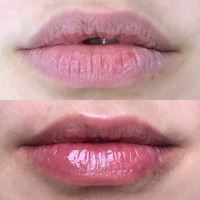OMI Menturm Medicated Lip Stick
