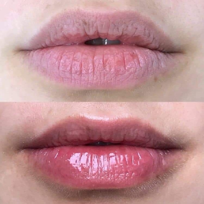 OMI Menturm Medicated Lip Stick