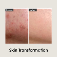 MEDI-PEEL Cica antio Cream 30ml