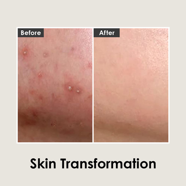 MEDI-PEEL Cica antio Cream 30ml