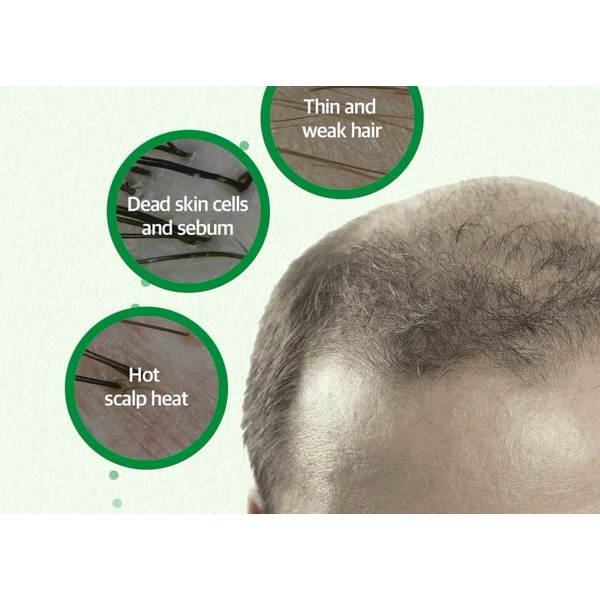 SOME BY MI CICA PEPTIDE ANTI HAIR LOSS DERMA SCALP TONIC 