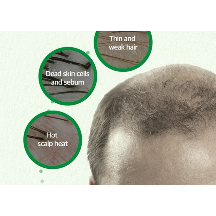 SOME BY MI CICA PEPTIDE ANTI HAIR LOSS DERMA SCALP TONIC 