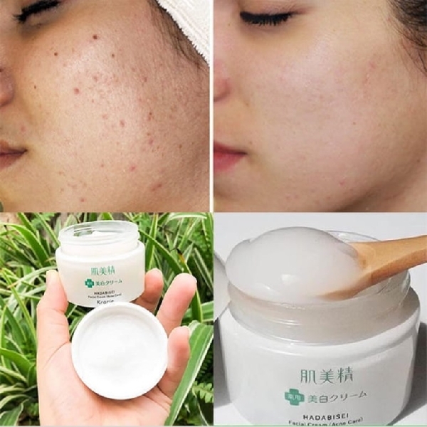 Kracie Hadabisei Facial Cream Acne Care 50g