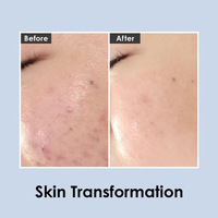 CENTALLA ACNE CREAM Medi-Peel Centella Mezzo Cream 30ml