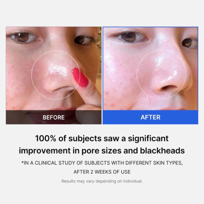 Medicube Zero Pore Pad 2.0 