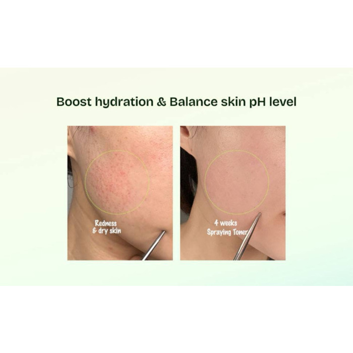 [Orien] MUGWORT SOOTHE IN TONER