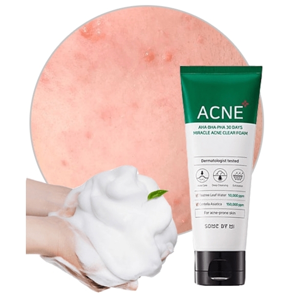 SOME BY MI AHA BHA PHA 30 Days Miracle Acne Clear Foam Cleanser 