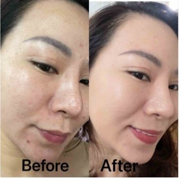 DONGSUNG Cream 70g