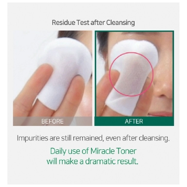 SOME BY MI AHA/BHA/PHA 30 Days Miracle Toner