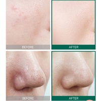 SOME BY MI AHA/BHA/PHA 30 Days Miracle Toner