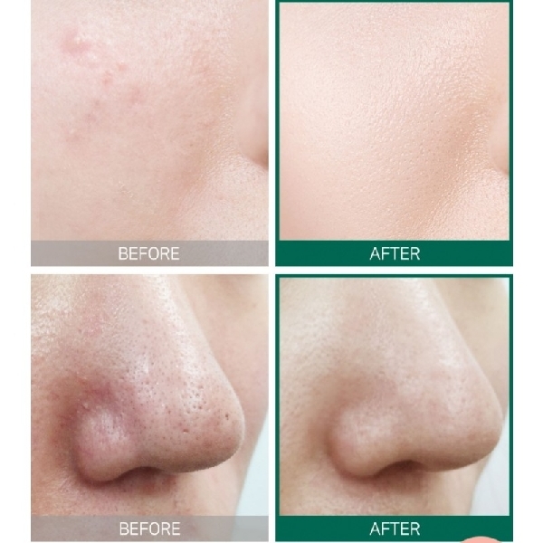 SOME BY MI AHA/BHA/PHA 30 Days Miracle Toner