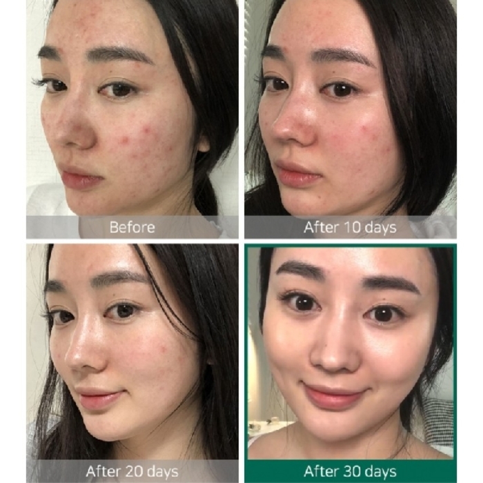 SOME BY MI AHA/BHA/PHA 30 Days Miracle Toner