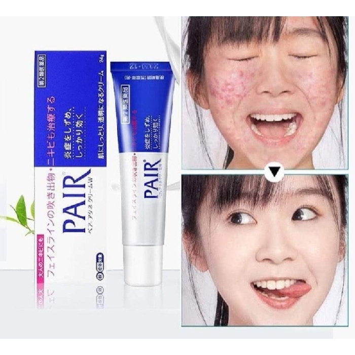 គ្រីមបន្តក់មុន Pair Acne Cream 24g - VTENH