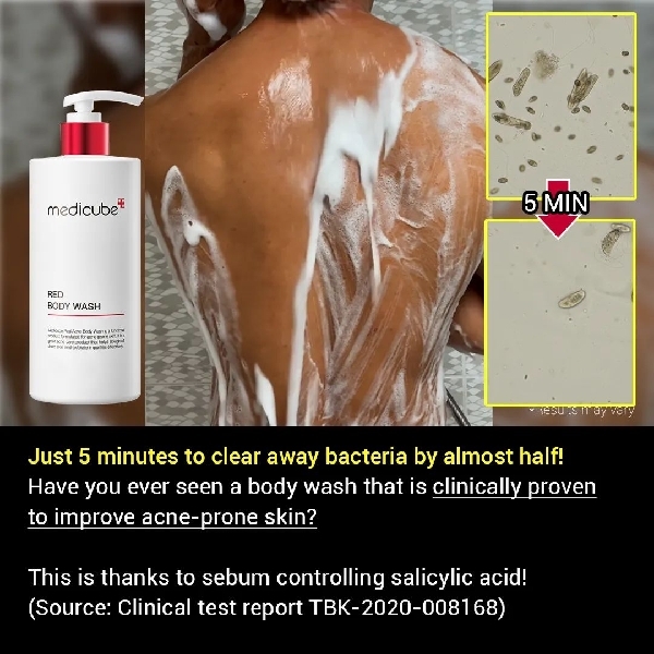 MEDICUBE Red Acne Body Wash 400ml