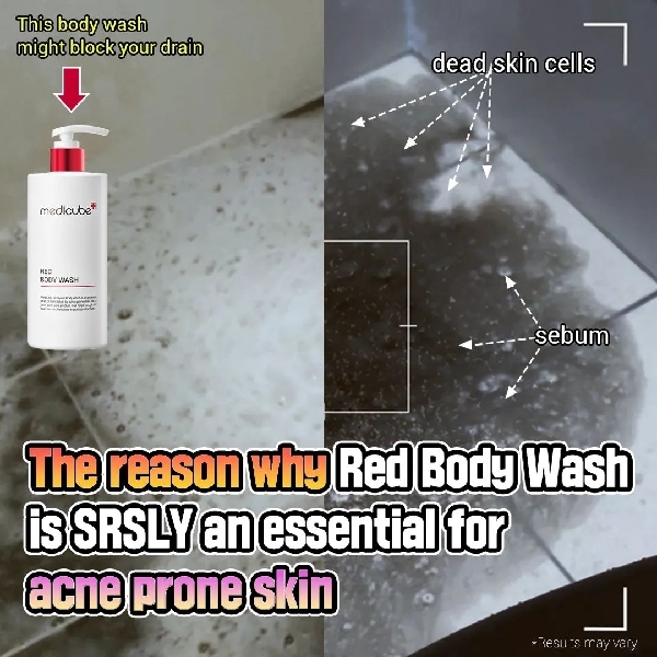 MEDICUBE Red Acne Body Wash 400ml