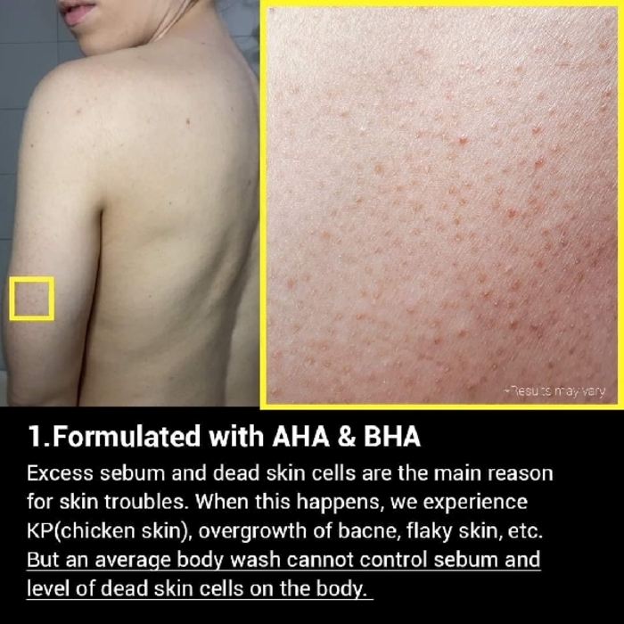 MEDICUBE Red Acne Body Wash 400ml