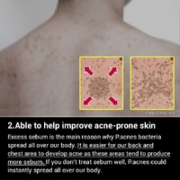 MEDICUBE Red Acne Body Wash 400ml