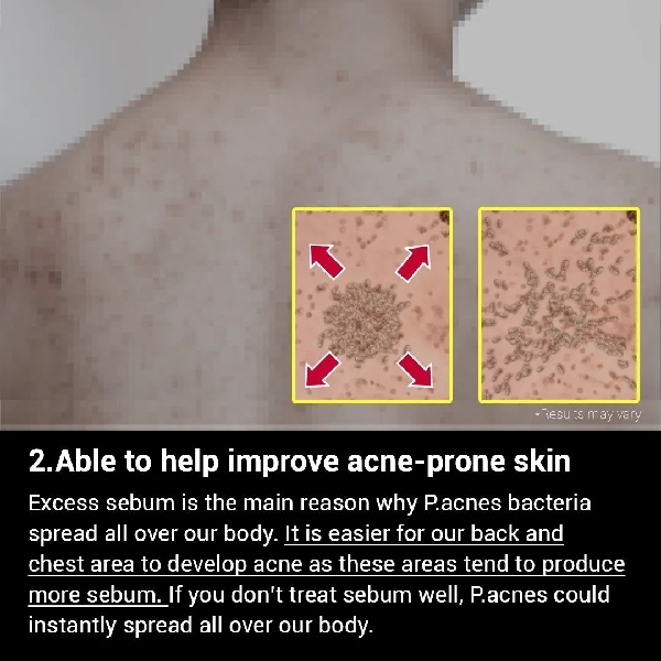 MEDICUBE Red Acne Body Wash 400ml