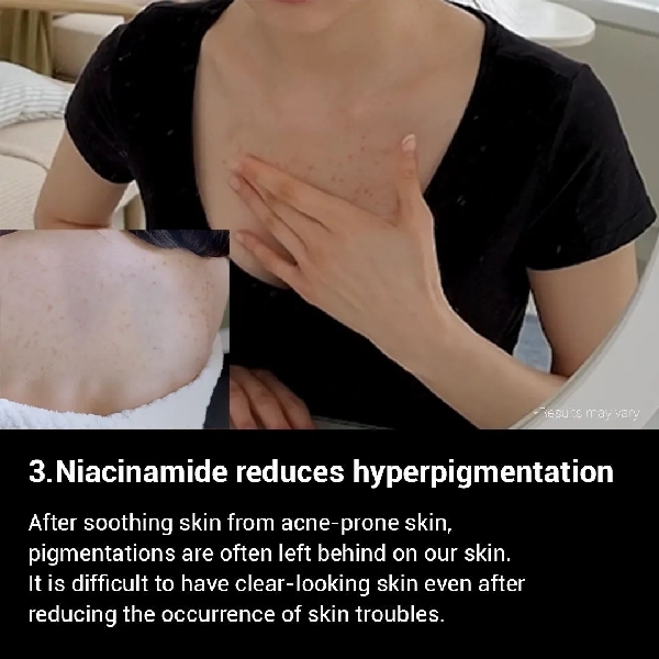 MEDICUBE Red Acne Body Wash 400ml