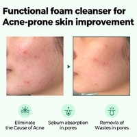 SOME BY MI Miracle Acne Cleansing Foam 