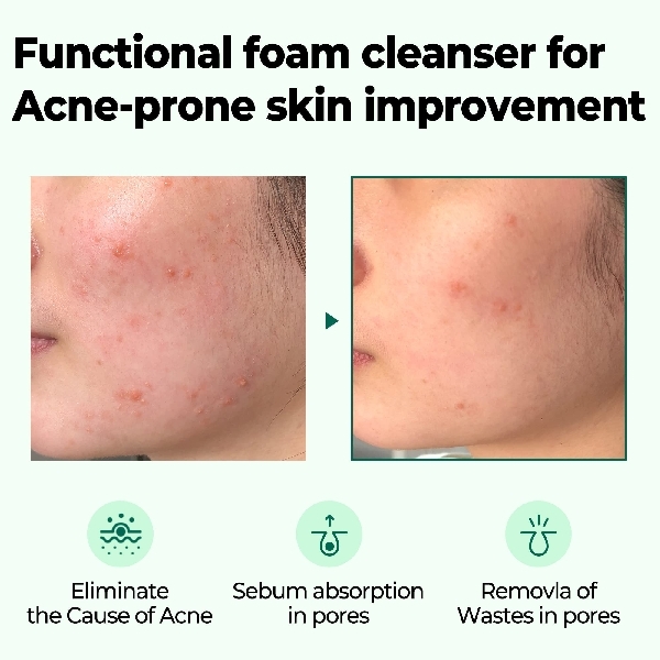 SOME BY MI Miracle Acne Cleansing Foam 