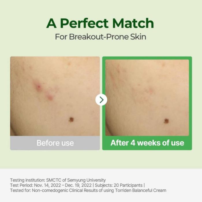 Torriden Centella Asiatica Extract Cream 