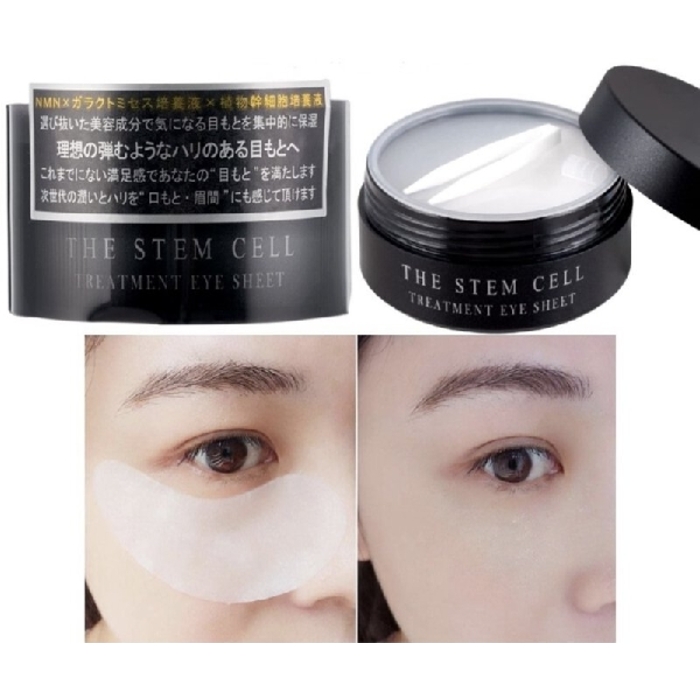 The Stem Cell Treatment Eye Sheet