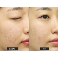 SOME BY MI Bye Bye Blemish Vita Tox Brightening Bubble Cleanser 120g