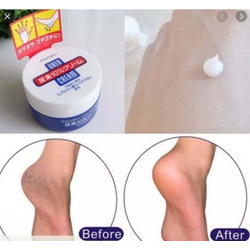 SHISHEIDO Urea Cream 100g