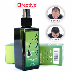 ថ្នាំបណ្តុះសក់ Neo Hair Lotion