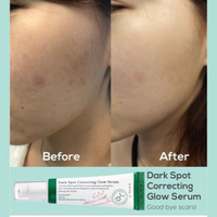 AXIS-Y Dark Spot Correcting Glow Serum 