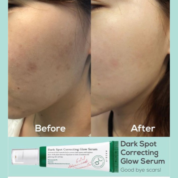 AXIS-Y Dark Spot Correcting Glow Serum 