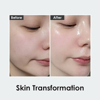 Volume BIO TOX pro Ampoule 