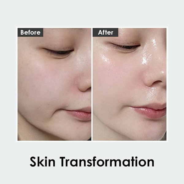 Volume BIO TOX pro Ampoule 