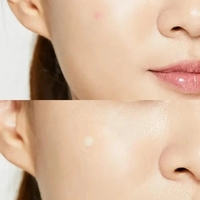 COSRX ACNE PIMPLE MASTER PATCH FAST ACTING