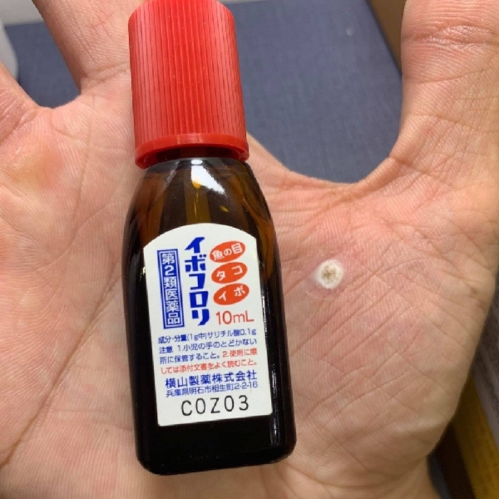 Ibokorori Wart Remover 10ml