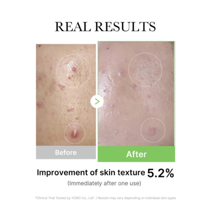 Medicube Exosome cica Ampoule