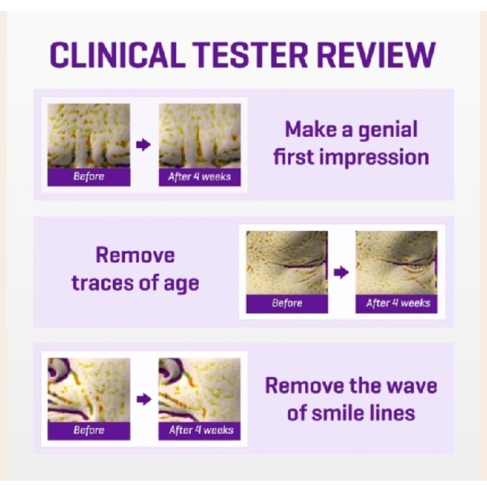 Some By Mi Retinol Intense Advanced Triple Action Eye Cream/គ្រីមក្រោមភ្នែក