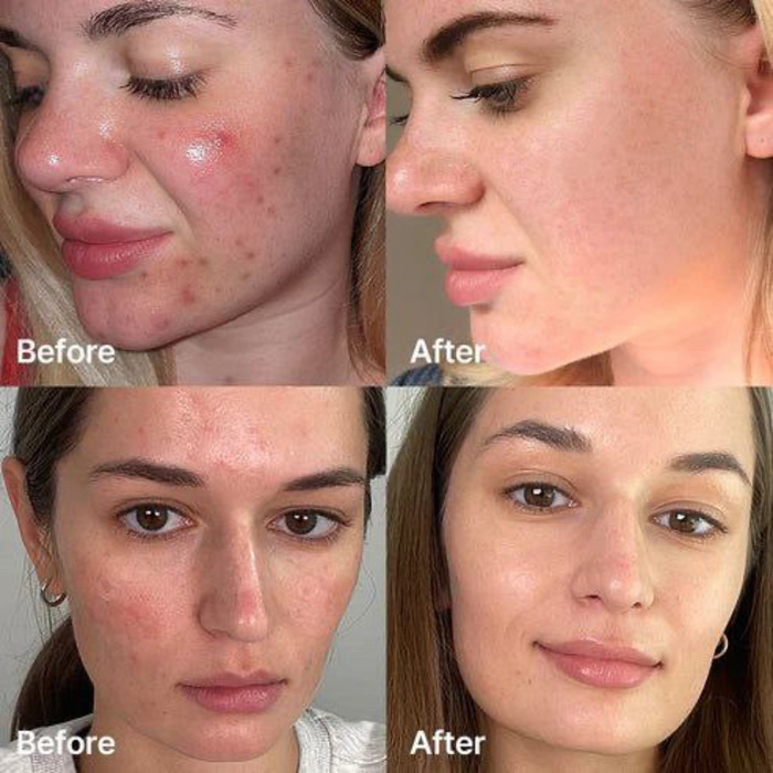 MEDICUBE red serum 