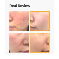 Some by mi Propolis B5 Glow Barrier Calming Starter kit 