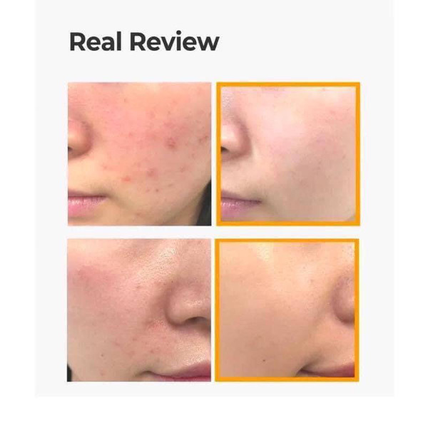 Some by mi Propolis B5 Glow Barrier Calming Starter kit 