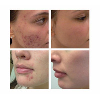 COSRX Salicylic Acid Daily Gentle Cleanser 150ml 