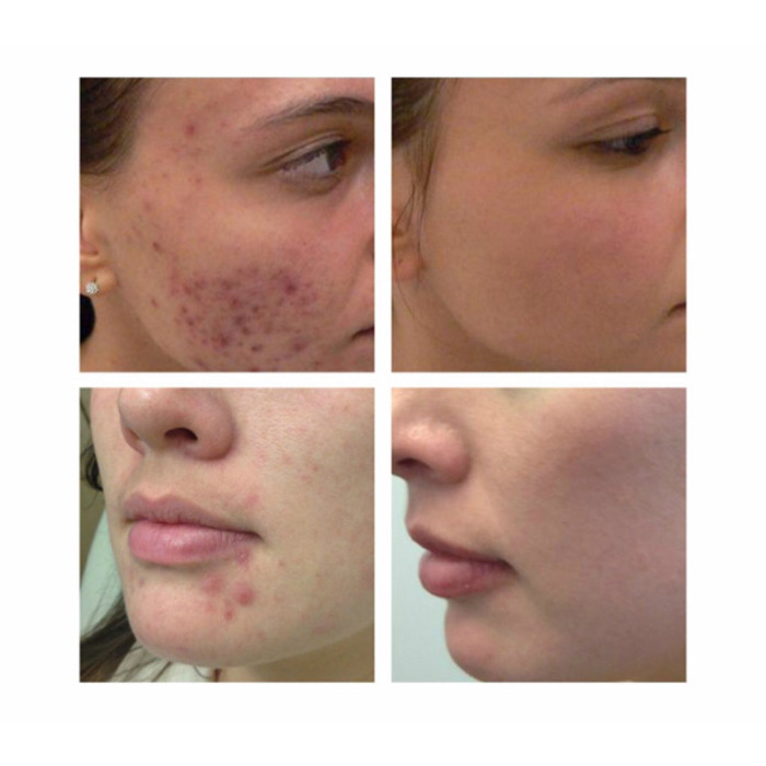 COSRX Salicylic Acid Daily Gentle Cleanser 150ml 