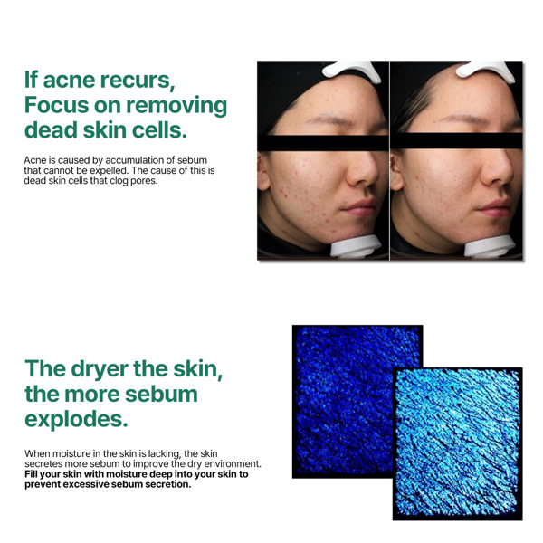 SOMEBYMI AHA,BHA,PHA 30days miracle Toner 