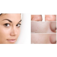 SQS Deep Concentrate Extra Moisture 15ml