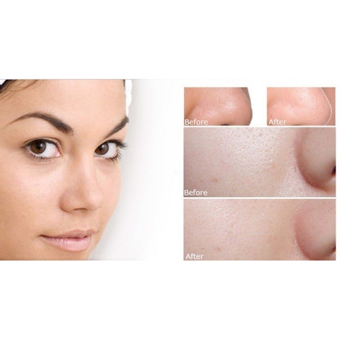 SQS Deep Concentrate Extra Moisture 15ml