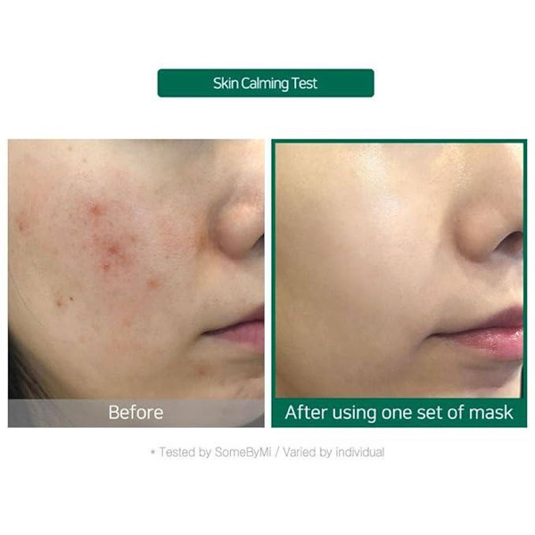[SOME BY MI] TEA TREE CALMING GLOW LUMINOUS AMPOULE MASK